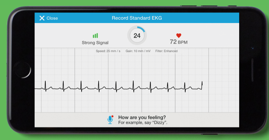 download the app and it's instant EKG. 