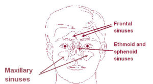 Diagram of sinus cavities.